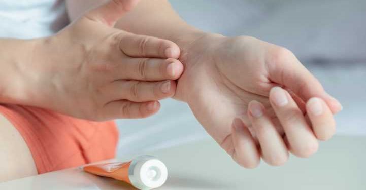 Anti-Inflammatory Gel
