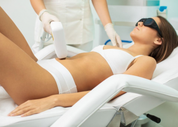 Laser Hair Removal
