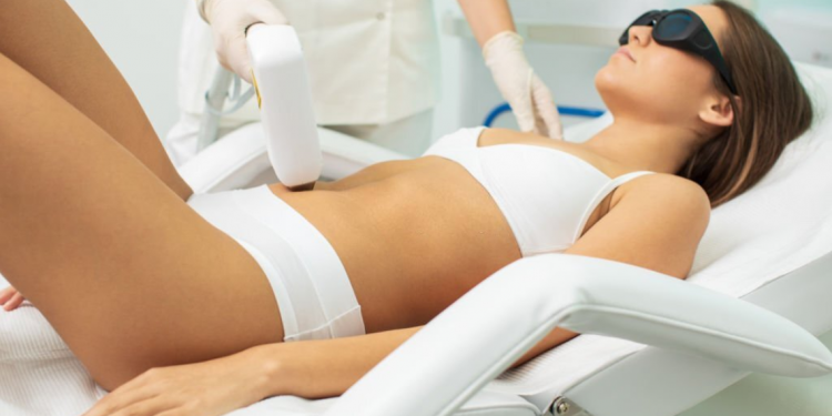 Laser Hair Removal